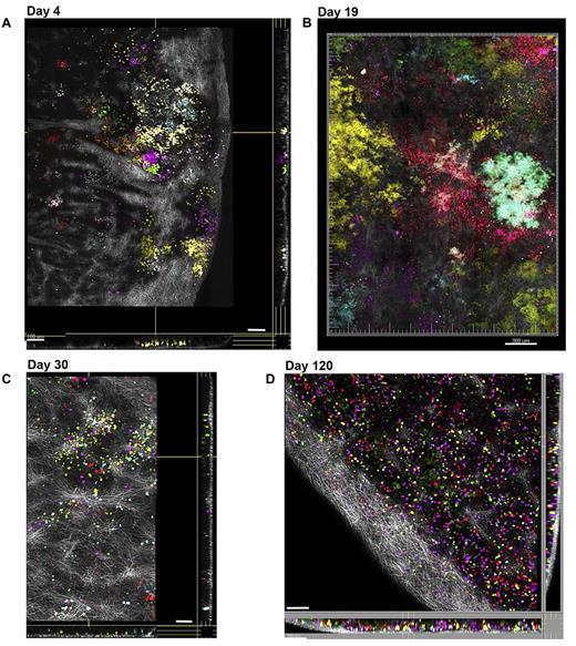Figure 4. Imaging hematopoietic progenitor clonal output in the spleen over time. In a single experiment, Co 5FP Lin− BM cells were transplanted into multiple recipient mice after total body irradiation. Intact spleens were removed at each time point, imaged over large volumes (1.2-mm × 1.6-mm × 100-μm), and are presented as extended focus sections across x, y, and z dimensions; the superficial layers of the capsule were removed computationally, facilitating visibility of the fluorescent cells underneath. (A) At day 4, numerous small clusters of diverse colors are visible under the collagen-rich capsule (SHG, white). (B) At day 19, very large clonal colonies or CFU-S diameter 500-600 μm (x-y) are present, with color homogeneity associated with each CFU, although by this time point there was clonal mixing at the edges of neighboring CFU-S. (C) At day 30, the large CFU-S had disappeared, with only small residual clusters of clonal cells enmeshed by collagen fibers. (D) At day 120, the spleen is repopulated by scattered nonclonal cells indicated by the color diversity and lack of clustering of cells of the same color. Scale bars represent 100 μm (A,C-D), 300 μm (B). Related images shown in supplemental Video 7.