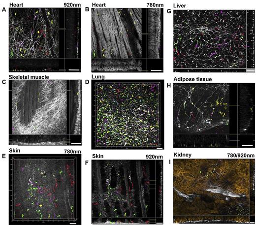 Figure 5. Detection of BM-derived cells in nonhematopoietic tissues after transplantation. Various tissues and organs were imaged intact at day 30 after transplantation of Lin− cells cotransduced with 5FP vectors (A-D,G-I) or Mix 5FP (E-F). Images are presented as extended depth of focus sections in x-y and x-z and y-z directions after computationally removing the outer layers of collagen fibers. In the heart viewed from the epicardial side, (A) numerous individual large fluorescent cells with macrophage-like morphology originating from multiple clones based on the diverse colors seen are visible along the superficial collagen fibers (SHG at 920 nm, white) and also (B) interspersed deeper between cardiomyocytes (white) visualized by their intrinsic 2-photon autofluorescence (at 780 nm). No FP fluorescent cardiomyocytes were observed. In skeletal muscle, (C) fluorescent cells were found within the external fibrous network (SHG, white) but also intercalating between individual striated muscle fibers (SHG, white). In the lung, (D) numerous fluorescent cells with a diverse palette of colors were scattered throughout at all depth levels, with variable morphologies suggesting dendritic cell, macrophage, and type 2 pneumocyte identities. An abdominal skin flap was imaged from the epidermal side (E) and the dermal side (F); fluorescent cells of diverse colors and morphologies were seen, most with large size and morphology suggesting Langerhans or dendritic-like identity, lying under elastin fibers (autofluorescence at 780 nm, white; E) and along collagen (SHG at 920 nm, white) muscle fibers and hair follicles (F). Groups of nearby cells of the same color suggest in situ proliferation of at least some of these cells. In the liver, (G) fluorescent cells with morphology suggestive of stellate cells or macrophages (Kupffer cells) of various colors were aligned along the collagen fiber network (SHG, white) delineating hepatic lobular structures. Nearby cells of the same color suggest in situ proliferation and short-distance migration. Adipose tissue (H) displayed individual cells or clonal clusters of fluorescent macrophage-like cells or small round lymphocyte-like cells interspersed along fibers (SHG, white) and outlining the large adipose cells. In the kidney, (I) examined from the capsule (collagen-SHG at 920 nm, white), rare small fluorescent cells were visible along collagen fibers in the interstitial space between tubules (golden) imaged via 2-photon autofluorescence (780 nm). Scale bars represent 100 μm (A-F), 50 μm (G-I). Related images shown in supplemental Videos 9-15.