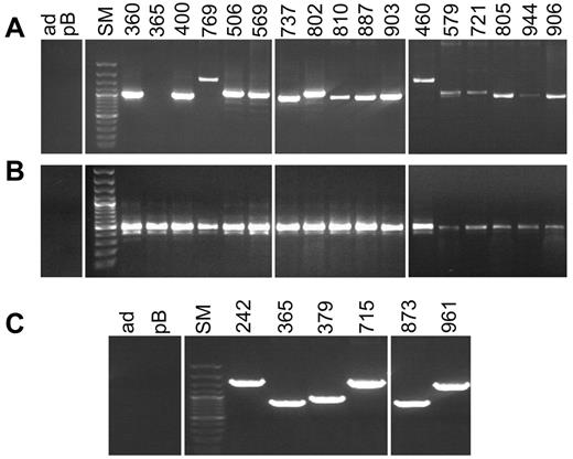 Figure 1. Identification of P2RY8-CRLF2 in childhood BCP-ALL cases. (A) PCR products of the genomic P2RY8-CRLF2 fusion of representative cases. Patient identification is indicated at the top of the gel: ad, nontemplate control; pB, peripheral blood MNCs; and SM, size marker. Left part of the gel (samples 360-903) shows PCR products from cases that were later defined as harboring the P2RY8-CRLF2 fusion in a major clone. Right part of the gel (samples 460-906) shows PCR products from ALL cases with P2RY8-CRLF2 in a minor subclone. (B) PCR for the fusion transcripts of corresponding cases. Note that sample 365 had no genomic PCR product but a distinct band for the transcript. (C) PCR products of the 6 cases with the newly discovered breakpoints upstream of CRLF2. A vertical line was inserted to indicate that different gels, run in parallel, from identical experiments were pasted together.