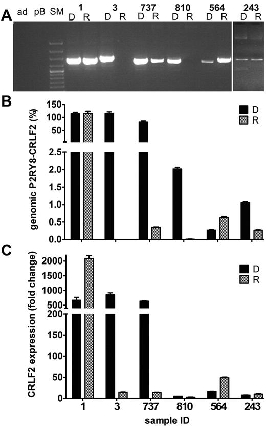 Figure 4. Patterns of genomic P2RY8-CRLF2 and CRLF2 transcripts of fusion-positive ALL relapse cases. The 6 different patterns of clonal relation between initial diagnosis (D) and relapse (R) leukemia are depicted. (A) Genomic PCR products for P2RY8-CRLF2 in representative cases. Sample identification is indicated at the top of the figure: ad, nontemplate control; pB, peripheral blood MNCs; and SM, size marker. Cases 1, 3, and 737 harbor the fusion in a major clone at initial diagnosis, and it was either conserved (1), lost (3), or reduced to a minor subclone (737) at relapse. In cases 810, 564, and 243 with a fusion-positive minor subclone at initial diagnosis, the fusion was also either lost (810), preserved (243), or replaced by a different fusion (564) at relapse. Quantification of the genomic P2RY8-CRLF2 fusion (indicated in percentage of leukemia cells at the y-axis; B) and the corresponding CRLF2 transcript levels (fold changes of normalized expression of the samples over the expression in peripheral blood MNCs; C). Sample identification is given at the bottom of the graph.