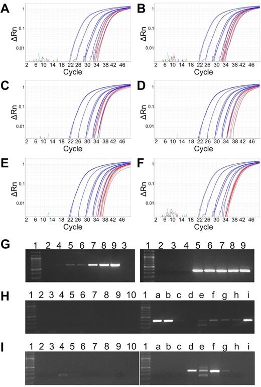 Figure 5. Detection of the P2RY8-CRLF2 in neonatal blood spots. Amplification plots of the qRT-PCR of genomic P2RY8-CRLF2 using whole genome–amplified genomic Guthrie card DNA of 6 ALL cases: 400 (A), 737 (B), 802 (C), 833 (D), 841 (E), and 887 (F). Standard curves showing a quantitative range of 1 × 10-5 (blue) and PCR products of Guthrie card DNA from 4 aliquots in triplicates (red). PCR products for P2RY8-CRLF2 with a newly identified genomic breakpoint of case 873. (G) Amplification of the genomic breakpoint. Dilution series of genomic leukemia DNA. (Left) First round. (Right) Second round. The fusion can be detected at the single cell level at 1 × 10-5 (lane 5). Lane 1, size marker; lane 2, H2O; lane 3, DNA mix from peripheral blood MNCs of healthy donors; and lanes 4 to 9, 10-log dilutions from 1 × 10-6 to 1 × 10-1. Amplification of P2RY8-CRLF2 in native (H) and whole genome–amplified Guthrie card (I) DNA. Lane 1, size marker; lane 2, H2O; lane 3, control DNA mix; and lanes 4 to 10, Guthrie cards DNA from a newborn who did not develop ALL later. a to i, PCR products from aliquots of the patients' Guthrie card DNA.