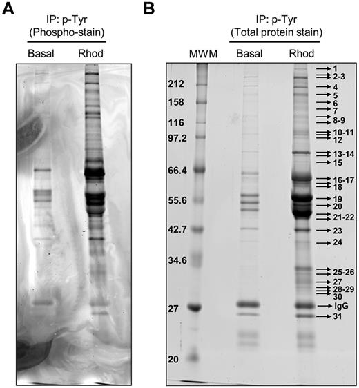 Figure 1. Tyrosine phosphoproteome analysis of rhodocytin-stimulated platelets. (A) Phosphoprotein staining of a 10% SDS-PAGE gel showing phosphorylated proteins obtained after 4G10 antiphosphotyrosine immunoprecipitation of basal and rhodocytin-stimulated platelets. (B) Total protein staining of the same gel showing all the proteins immunoprecipitated with the 4G10 antibody in basal and rhodocytin-stimulated platelets. Indicated bands were excised from the gel and analyzed by MS. Proteins identified are reported in supplemental Table 1. Basal indicates basal platelets; Rhod, platelets stimulated with rhodocytin (300nM, 5 minutes); and IP, immunoprecipitation.