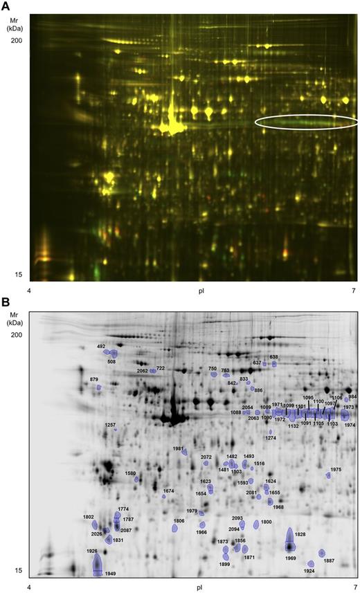 Figure 4. High-resolution 2D-DIGE proteome analysis of rhodocytin-activated platelets. Proteins were labeled with the corresponding Cy-dyes (“Methods”) and separated using isoelectric focusing (pH range 4-7, 24 cm) and 10% SDS-PAGE gels. (A) Representative image of the 2D-DIGE analysis where the fluorescence emission from Cy3 and Cy5 dyes is superimposed. Green color spots are up-regulated in rhodocytin-stimulated platelets, whereas red-orange color spots are down-regulated. The array of altered spots that contained the protein pleckstrin is indicated. (B) Representative image of the analysis in gray scale. Spots differentially regulated comparing nonstimulated and rhodocytin-activated platelets are indicated. Further information about protein identifications can be found in supplemental Table 2.