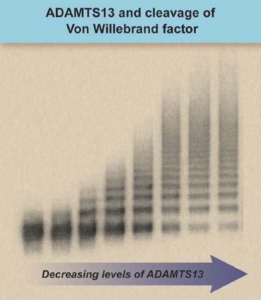 Western blot showing the reduction of von Willebrand factor cleavage and presence of large multimers with decreasing levels of ADAMTS13 activity (left to right; according to Furlan et al9). Professional illustration by Debra T. Dartez.