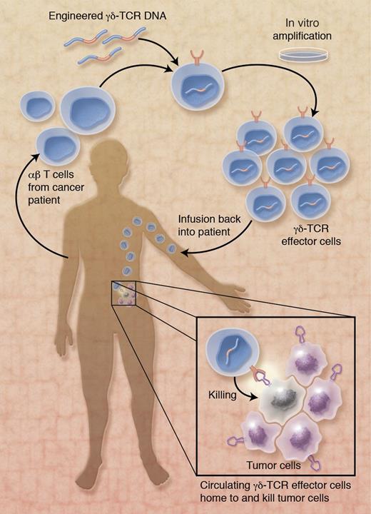 Application of γδ-TCR–expressing effector cells in immunotherapy of cancer patients. αβ T cells from a cancer patient are genetically modified to stably express optimized, high-avidity γδ-TCRs with broad range tumor cell killing activity. After expansion during in vitro culture and infusion into the cancer patient, circulating γδ-TCR effector cells home to the tumor and kill tumor cells. The ligand on tumor cells that is recognized by engineered γδ-TCRs is not known. Professional illustration by Alice Y. Chen.