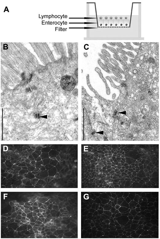 Figure 1. Microscopic observations of tight junctions between Caco-2 cells cocultured with HTLV-1–infected or uninfected lymphocytes. (A) Experimental setting to study the viral passage after coculture. Caco-2 cells were cultured on Transwell filters before the addition of HTLV-1–infected (or uninfected) lymphocytes to the apical compartment. Two days later, cocultures were fixed and processed for observations by transmission electron microscopy or immunofluorescence microscopy. (B-C) Transmission electron microscopy showing tight junctions (indicated by black arrows) between epithelial cells cocultured with uninfected lymphocytes (B) and with HTLV-1–infected lymphocytes (C). Scale bar indicates 1 μm. Observation was with a JEOL 1010 transmission electron microscope operating at 80 kV. Image acquisition was with a Nikon CCD camera. (D-G) Detection of tight-junction proteins by immunofluorescence. Immunoreactivity for occludin and ZO-1 (D-E and F-G, respectively) could be detected according to the same pattern between epithelial cells cocultured with uninfected lymphocytes (D,F) or with HTLV-1–infected lymphocytes (E,G). Original magnification, 200×. Observation was with a Leica DMRB microscope equipped for fluorescence. Image acquisition was with a Nikon Coolpix 8400 camera.