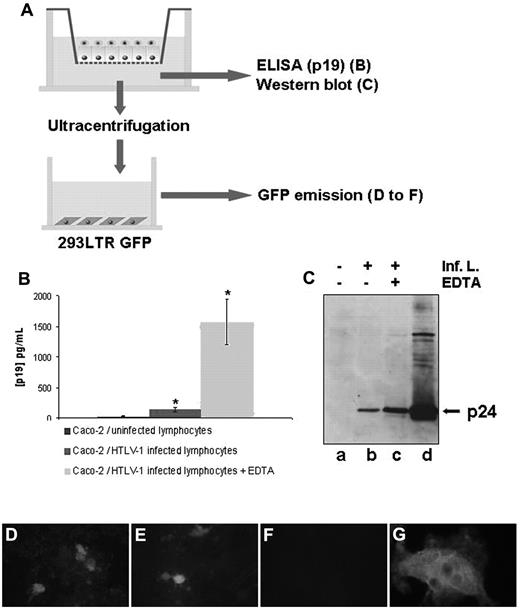 Figure 4. Assessment of viral passage across a tight human epithelial barrier. (A) Experimental setting to study the viral passage after coculture. Caco-2 cells were cultured on Transwell filters before the addition of HTLV-1–infected or uninfected lymphocytes to the apical compartment. After 48 hours of coculture, basal medium was harvested for p19 measurement by ELISA (B), p24 measurement by Western blot (C), or ultracentrifuged. After resuspension, the pellet was analyzed for the presence of infectious virions by incubation with 293-LTR-GFP cells by GFP emission assay (D-F) or p24 immunoreactivity (G) of these cells. (B) The p19 viral protein content in the basal compartment was determined by an ELISA assay after a 48-hour coculture of Caco-2 cells with HTLV-1–infected lymphocytes on Transwell filters (middle column). A significant amount of p19 protein was detected compared with epithelial cells cocultured with uninfected lymphocytes (left column). *P < .05. Right column shows the positive controls, which were treated with EDTA. Mean values from 3 experiments are shown. (C) Western blot detecting p24 protein in the basal compartment after ultracentrifugation (lane a, coculture with uninfected lymphocytes; lane b, coculture with epithelial cells/HTLV-1–infected lymphocytes; lane c, coculture with HTLV-1–infected lymphocytes treated with EDTA). The whole-cell lysate of infected lymphocytes is shown in lane d. (D-G) Presence of infectious virions in the basolateral chamber. Medium of the basal compartment of a coculture (Caco-2/HTLV-1–infected lymphocytes for 48 hours) was ultracentrifuged and incubated for 5 days on 293T-LTR-GFP cells after assessment of GFP gene expression to detect transactivation by the viral Tax protein. (D) Transactivation of the viral promoter LTR by infectious virions contained in the basal compartment after coculture with HTLV-1–infected lymphocytes. € EDTA-treated positive control. (F) Negative control with the medium derived from a coculture with CEM-uninfected lymphocytes. (G) Detection of p24 immunoreactivity and syncytium formation in 293-LTR-GFP cells incubated with ultracentrifuged pellet from the basal compartment of Caco-2 coculture with HTLV-1–infected lymphocytes, as in panel D. For panels D-F, original magnification was 200×; for panel G, 400×. Observation was with a Nikon Microphot FxA (D-F) or a Leica DMRB (E) microscope equipped for fluorescence.
