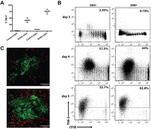 Figure 1. Tim-3/gal-9 expression is up-regulated during acute GVHD. (A) B6 mice were lethally irradiated (11.0 Gy) and infused with 107 MHC-mismatched BALB/c NTCD BM and 3 × 106 BALB/c purified T cells. Recipient mice were killed on day 7, along with 3 naive BALB/c mice for control, and the spleens were examined by flow cytometry for Tim-3 expression. Cells were gated on CD4 or CD8 positive, H-2Kd positive events. (B) CFSE-labeled BALB/c purified T cells (107) were transferred into lethally irradiated B6 recipients. Spleens were harvested and analyzed by flow cytometry for CFSE dilution and Tim-3 expression on days 3, 4, and 5. Data shown are representative of 4 mice per group per day. Cells were gated on CD4 or CD8 positive, H2Kd positive events. Numbers indicate percentage of Tim-3+ cells. (C) B6 mice were lethally irradiated and infused with 107 BALB/c NTCD BM and 3 × 106 BALB/c purified T cells and killed on day 7. Cryosections from the spleen of BM only recipients (top) and T-cell recipients (bottom) were stained for CD45 in FITC (shown in green) and gal-9 (shown in red). Original magnification ×20. Pictures are representative of 2 experiments, with 3 to 4 mice/group.
