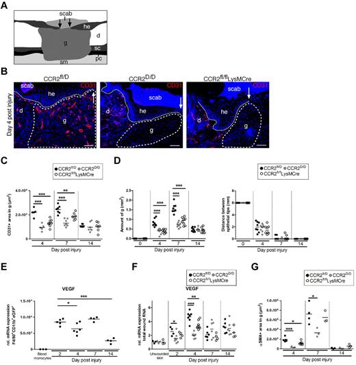 Figure 4. CCR2 is critical for the recruitment of proangiogenic monocytes/macrophages into skin wounds. (A) Scheme illustrating skin wound histology. (B-D) CD31 immunostaining (B) and morphometric quantification of CD31-stained (C) or H&E-stained (D) wound tissue at different time points after injury. (E-F) qRT-PCR analysis for VEGF in F4/80+CD11b+eGFP+ macrophages isolated from CCR2fl/D mice normalized to expression in SSClowCD11b+CD115+ blood monocytes (E) and in wound tissue from mutants at different time points after injury normalized to unwounded skin (F). (G) Morphometric quantification of αSMA-stained wound tissue of the indicated mouse strains. Three independent experiments were performed and each dot represents 1 wound. Hatched line indicates granulation tissue; dotted line, hyperproliferative epithelial tongue; arrows, tip of epithelial tongue; d, dermis; g, granulation tissue; he, hyperproliferative epithelium; sc, subcutaneous fat tissue; pc, panniculus carnosus; and sm, skeletal muscle. Bars indicate 100 μm. *P < .05; **P < .01; ***P < .001.