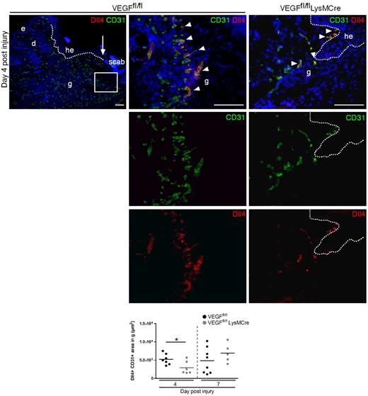 Figure 7. Macrophage-derived VEGF controls vascular sprout induction during the early phase of tissue repair. Shown are CD31/Dll4 double immunostaining and morphometric quantification of wound tissue. Left, rectangle outlines vascular structures within granulation that are presented at higher magnification in images presented in the middle. Arrow indicates the tip of epithelial tongue; dotted line, hyperproliferative epithelial tongue; arrowheads, front of sprouting tips; he, hyperproliferative epithelium; and g, granulation tissue. Scale bar indicates 100 μm. Three independent experiments were performed and each dot represents 1 wound. *P < .05.