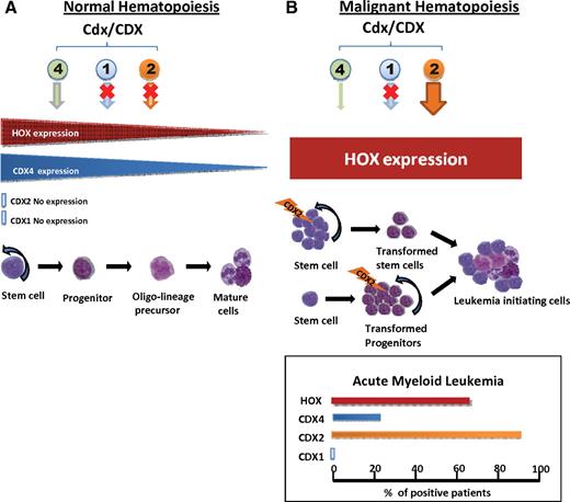 Figure 2. Cdx expression in normal and malignant hematopoiesis. (A) Normal hematopoiesis.Cdx4 and HOX A and B cluster genes are expressed in normal stem and progenitor cells, whereas Cdx2 and Cdx1 remain silenced. (B) Malignant hematopoiesis. Ectopic expression of CDX2 at the level of stem or progenitor cells induces increased expression of Hox A and B cluster genes and leukemic transformation of hematopoietic cells. The proportion of patients with AML, which ectopically express CDX2 and overexpress HOX genes, is indicated. CDX4 is expressed only in a minority of patients, and CDX1 expression is not detectable in patients with leukemia.