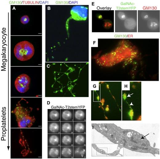 Figure 2. Golgi redistribution during thrombogenesis. (A) Immunofluorescence micrographs of immature and proplatelet-producing megakaryocytes showing Golgi remodeling into condensed vesicles that move into proplatelets during megakaryocyte maturation. Tubulin is visualized with an antitubulin mAb (red); nuclei by DAPI staining (blue); Golgi by anti-GM130 Abs (green). The micrographs are representative of > 10 experiments. Scale bar indicates10 μm. (B-C) Location of GM130 in proplatelets. Golgi is fragmented and condensed into small vesicular structures (green). Scale bar indicates 10 μm. (D) Kinetics of the Golgi disassembly in a mouse megakaryocyte transfected with the Golgi marker GalNAc-T2-stem-YFP. Panels of micrographs selected from 77 minutes of real-time observation. (E) Double immunofluorescence microscopy of transfected megakaryocyte with GalNAc-T2-stem-YFP using anti-YFP (green) and anti-GM130 (red) Ab. Colocalization was seen in cells expressing GalNAc-T2-stem-YFP regardless of the maturation level (not shown). (F) Immunofluorescence microscopy of differentiated megakaryocytes using the Golgi marker anti-GM130 Ab (green) and the endoplasmic reticulum (ER) marker Calnexin (red). (G-H) Arrow shows GM130 accumulation in a proplatelet swelling. Between swellings, small GM130-containing vesicles are stained. (I) Electron micrograph of a section of a proplatelet extension/swelling containing a small Golgi-like vesicular stack (arrow).