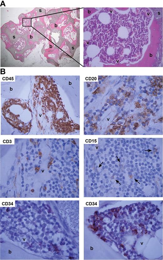 Figure 1. Artificial humanized bone microenvironment acts as a natural hematopoietic niche. (A) To generate a humanized bone environment, RAG2−/−γc−/− mice were implanted with human MSC-loaded BCP scaffolds (s). Eight weeks after implantation, this led to the formation of human bone (b) in the vascularized (v) open spaces that was capable of supporting mouse hematopoiesis. Representative H&E-stained slides are shown. (B) CD34+ UCB cells engraft and differentiate in humanized ossicles. RAG2−/−γc−/− mice implanted with MSC-loaded BCP scaffolds and injected with CD34+ cells at week 8 and analyzed at week 16 revealed ossicles with human CD45+ cells (CD45). These included B cells (CD20), T cells (CD3), and myeloid cells (CD15). Undifferentiated CD34+ cells (CD34) were detected adjacent to both bone (b) and vessels (v). Shown are representative images of immunohistochemical stainings for human CD markers.