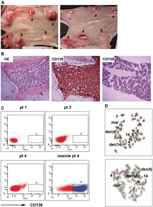 Figure 2. Humanized mice allow engraftment and growth of primary MM cells. (A) Mice were implanted with 4 MSC-loaded BCP scaffolds (#); one control was loaded with MSCs and exposed to 30 Gy of x-rays before implantation (*) and the other control was without MSCs (§). Mice were inoculated with mononuclear cells (MNCs) from patient 3 either directly into the ossicles (left panel) or by intracardiac injection (right panel). Representative images of ossicles inoculated via both injection procedures are shown. (B) Immunohistochemical sections of an ossicle from a humanized mouse inoculated with MNCs of patient 4 stained by HE (left panel) or anti–human CD138 (middle panel), and the femur of the corresponding mouse stained by anti–human CD138 (right panel). Representative pictures are shown. (C) Flow cytometric analysis of the blood and ossicles of humanized mice with anti–human CD138. Representative flow cytometry plots of the blood of mice inoculated with MNCs of patient 1, 3, and 4, and cells retrieved from an ossicle of a mouse inoculated with MNCs of patient 4 are shown. (D) FISH analysis of MNCs of patient 4 and cells retrieved from an ossicle of a mouse inoculated with MNCs of patient 4 for t(4;14)(p16;q32). Shown are 2 representative pictures hybridized with the LSI IGH/FGFR3 probes of metaphase cells of patient 4 (top panel) and corresponding mouse (bottom panel). der(4) indicates derivative chromosome 4; der(14), derivative chromosome 14; mar, marker chromosome; and 4 and 14, normal copies of chromosomes 4 and 14.