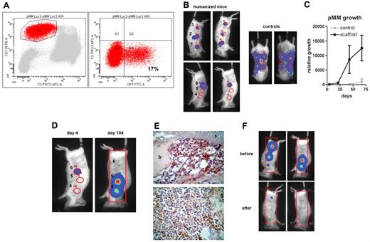 Figure 4. Primary MM cells can be luciferase gene marked, which allows real-time analysis of pMM cell growth. (A) Mononuclear cells of patient 3 were gene marked with luciferase and green fluorescent protein (GFP). Transduction efficiency was analyzed using anti–CD138-PE, TO-PRO-3-iodide, and green fluorescent protein 48 hours after transduction. (B-F) Humanized mice were created by implanting mice with 4 MSC-loaded BCP constructs (sites 2-5) and 2 controls, 1 loaded with MSCs and exposed to 30 Gy of x-rays before implantation (site 1) and the other without MSCs (site 6). Humanized and control mice (ie, mice without ossicles) were inoculated with luciferase-marked pMM cells of patient 3 at 4 sites directly into the ossicle (sites 1-3 and 6) or subcutaneously, respectively, and followed by BLI. (B) BLI images from humanized and control mice 4 days after injection. (C) Tumor growth was determined by average photon emission intensity measured for a region of interest in time. The results are expressed as relative growth with the intensity at day 4 set to 100. The lines represent the mean signal of 2 mice ± SD. (D) BLI images of a representative mouse at day 4 (left panel) and day 104 (right panel) after injection with transduced pMM cells, indicating migration of pMM cells to noninjected sites 4 and 5. (E) Immunohistochemical analysis of ossicles for luciferase with the scaffold material (s) covered with bone (b) and infiltrated by pMM cells. (F) A pMM-carrying humanized mouse was subjected to total body irradiation (6 Gy x-rays) and analyzed by BLI 2 weeks before and after irradiation.