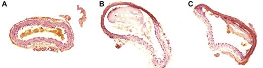 Figure 3. Pathologic sections of carotid artery thrombosis. (A) The histologic section of a normal carotid artery, stained with hematoxylin and eosin; (B-C) FeCl3-treated vessels. Section of (B) a control mouse and (C) from a mouse treated with PN2KPI.
