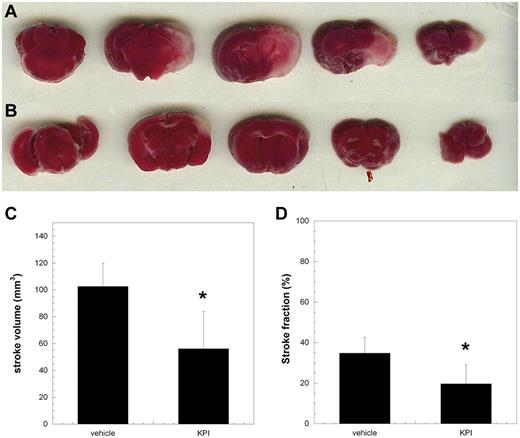 Figure 4. Coronal sections of the brains of mice treated either with vehicle or PN2KPI. The ischemic region of brain is indicated by the pale area within the right hemisphere of animals treated with vehicle (A) or PN2KPI (B) 24 hours after right middle cerebral artery occlusion. (C-D) The comparison of the stroke volume and stroke fraction between the 2 groups (n = 6 in each group, P < .05). The bars represent the mean ± SEM of stroke volume values. *Significant differences with P < .05 compared with the control group.