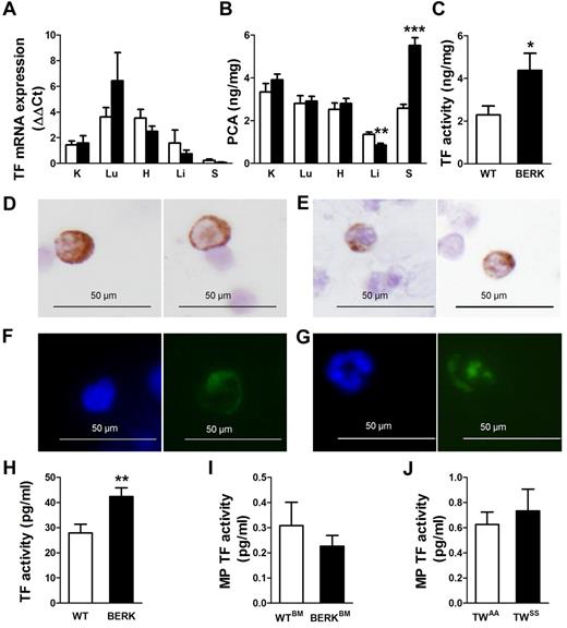 Figure 1. TF expression in sickle cell mice. (A) TF mRNA expression and (B) procoagulant activity (PCA) in organs of WT (open bar; n = 9) and BERK mice (filled bar; n = 8). K indicates kidney; Lu, lung; H, heart; Li, liver; and S, spleen. Asterisks directly above the bars indicate statistically significant difference compared with WT controls: **P < .01 and ***P < .001. (C) TF-dependent PCA activity in the spleens of WT (open bar) and BERK mice (filled bar). *P < .05. Immunocytochemistry (D-E) or immunofluorescence (F-G) staining demonstrates TF-positive leukocytes with nuclear morphology resembling monocytes (D,F) or neutrophils (E,G). TF is shown as brown staining (top panels) or green staining (bottom panels). Nuclei are stained blue. (H) TF activity of the leukocytes isolated from the same volume of blood obtained from WT (n = 13) or BERK (n = 10) mice. **P < .01. (I) TF activity of the microparticles (MP TF) isolated from the plasma of WT (open bar; n = 6) and BERK (filled bar; n = 15) mice. (J) MP TF activity in TWAA (open bar; n = 13) and TWSS (filled bar; n = 17) mice.
