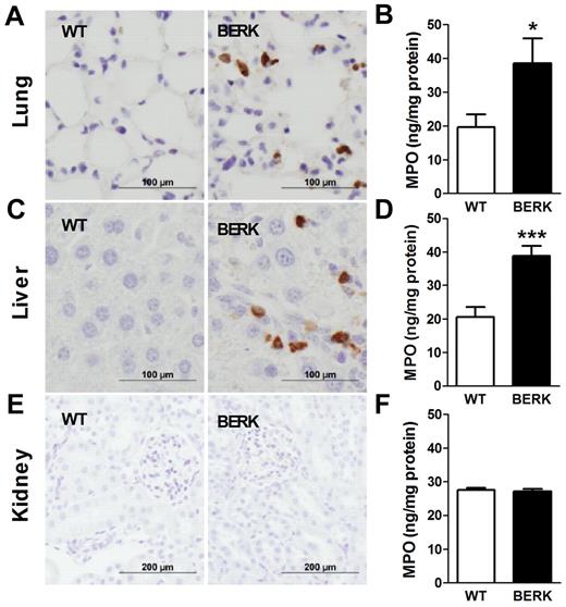Figure 5. Neutrophil infiltration and activation in various organs of BERK mice. Neutrophils (brown staining) are present in the lungs and livers, but not kidneys, of BERK mice. Tissue levels of MPO were determined in the organs of WT (n = 8 or 9) and BERK (n = 10-12) mice. Asterisks directly above the bars indicate statistically significant difference compared with WT group: *P < .05.