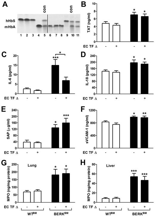 Figure 7. Role of endothelial cell TF in the activation of coagulation, inflammation, and endothelial cell activation in sickle cell mice. (A) Representative gel demonstrating the analysis of different hemoglobin types by cellulose acetate electrophoresis in TFflox/flox,Tie-2 Cre mice transplanted with bone marrow from BERK mice (lines 1-3 and 9) or WT mice (lines 4 and 6-8). Upper and lower bands correspond to human sickle hemoglobin and normal mouse hemoglobin. Lines 5 and 10 contain positive controls (con) for both forms of hemoglobin. Line 11 shows the example of unsuccessful transplantation of bone marrow from BERK into TFflox/flox,Tie-2 Cre mouse. Mice like this were excluded from experiments. A vertical line has been added to indicate 2 separate gels. (B-H) Plasma levels of TAT, IL-6, IL-18, SAP, and sVCAM-1 as well as tissue levels of MPO in lung and liver were analyzed in WT (open bar) and sickle cell mice (filled bar) with (+) or without (−) TF gene deletion in endothelial cells (EC TF Δ; n = 9-14). Asterisks directly above the bars indicate statistically significant difference compared with WTBM controls within the same treatment: *P < .05; **P < .01; and ***P < .001.