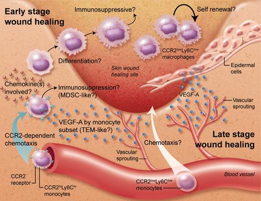The involvement of CCR2-mediated monocyte recruitment and monocyte-derived VEGF-A in early vessel sprouting during skin wound healing. At later stages, more mature macrophages are found and VEGF-A production switches to epidermal cells. Professional illustration by Alice Y. Chen.