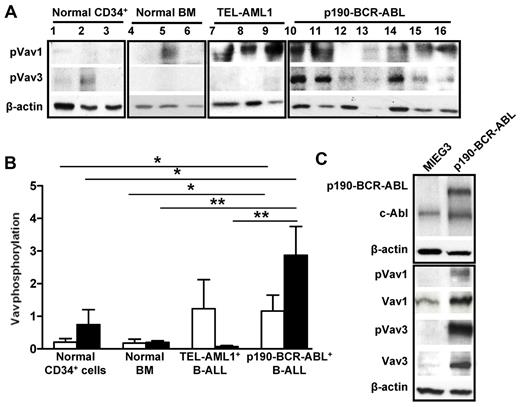 Figure 1. Vav1 and Vav3 are overexpressed and overactivated in p190-BCR-ABL ALL. (A) Representative immunoblot of phospho-Vav1 and phospho-Vav3 in human cells. Lanes 1 through 3 are CD34+ cells from healthy donors; lanes 4 through 6 are LDBM cells from healthy donors; lanes 7-9 are LDBM cells from patients with TEL-AML1+ B-ALL; and lanes 10 through 16 are LDBM cells from 7 patients with p190-BCR-ABL+ B-ALL. β-actin expression analysis was used as a loading control. Two independent experiments were run with the same specimens. (B) Normalized phosphorylation of Vav1 (empty bar) and Vav3 (solid bar) from the samples in panel A. The ratio was generated by dividing the densitometric value of each phosphorylated protein by that of β-actin from the same sample. Values represent average ± SEM. *P < .05; **P < .01. (C) Immunoblot of phosphorylated forms (Vav1-pTyr174 and Vav3-pTyr173) compared with total Vav1 and Vav3 in sorted murine B-220+/c-kit+/CD43+/EGFP+ B-cell progenitors transduced with either an empty vector (MIEG3) or p190-BCR-ABL.