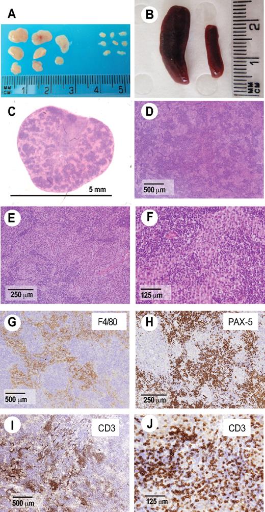 Figure 1. AITL-like pathology in Roquinsan/san mice. (A-B) Roquinsan/san mice develop generalized lymphadenopathy (A) and splenomegaly compared with Roquin+/+ littermate controls (B). Lymph node sections were stained with hematoxylin and eosin (C-F) or antibodies to the macrophage marker F4/80 (G), B-cell marker pax-5 (H), or the pan-T-cell marker CD3ϵ (I-J). Enlarged lymph nodes are characterized by a polymorphic infiltrate containing plasma cells (E), macrophages (F-G), and atypical T cells sometimes forming a rosetta pattern characteristic of AITL (J). Pictures are representative of 4 mice analyzed, all 26 to 40 weeks of age.
