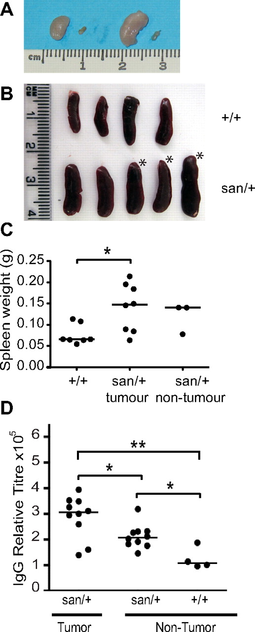 Figure 2. Roquinsan/+ mouse develop asymmetric lymphoadenopathy and splenomegaly. (A) Comparison of enlarged cervical and inguinal lymph nodes with the contralateral normal lymph node in a Roquinsan/+ female mouse. (B) Representative diagram of spleens from 5 Roquinsan/+ and 4 Roquin+/+ control age-matched mice. *Mice with lymphadenopathy. (C) Spleen weights of Roquinsan/+ mice separated into those with and without lymphadenopathy compared with Roquin+/+ controls. Mice were 18 to 40 weeks of age. (D) Total serum IgG titres assayed by ELISA. Roquinsan/+ mice with lymph node tumors have a statistically significant increase in serum IgG titres compared with nontumor Roquinsan/+ mice: *P < .05; **P < .01.