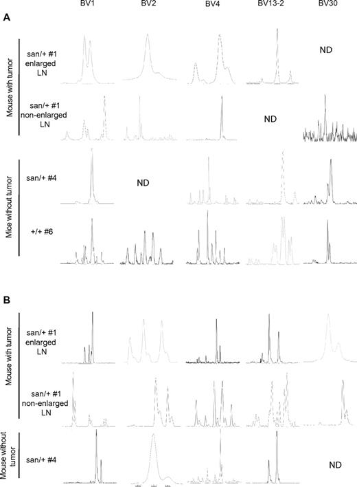 Figure 6. Tumors from Roquinsan/+ mice exhibit T-cell clonality. TFH (A) and non-TFH cells (B) isolated from the lymph nodes of Roquinsan/+ mice with or without tumors and lymph nodes from Roquin+/+ mice. In mice with tumors, a nonenlarged lymph node was also analyzed for clonality. Cells were purified by flow cytometry. TCRV-β chains were amplified by PCR and clonality determined by CDR3 spectratyping. #Mouse number, as in Table 3. Analysis of non-TFH cells from Roquin+/+ mice was not performed. Panels show 5 representative TCRV-β chains selected on the basis of those expressed in most samples. ND indicates not detected. All mice were 26 to 40 weeks of age.
