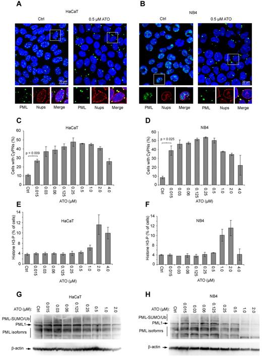 Figure 1. ATO stimulates formation of CyPNs. (A-B) IF of HaCaT and NB4 cells treated for 24 hours with or without 0.5μM ATO. Antibodies against PML (green) and nucleoporins (red; inset) were used. DAPI is shown in blue. Scale bar, 20 μm. (C-D) Quantification of CyPNs in HaCaT and NB4 cells treated with indicated ATO concentrations for 24 hours. For each sample more than 200 cells were analyzed. Data represent average of 2 independent experiments ± SD. (E-F) Determination of percentage cells in mitosis. HaCaT (E) and NB4 (F) cells treated with the indicated concentrations of ATO for 24 hours were analyzed by flow cytometry using phospho-histone H3 as a marker. Data represent average of 2 independent experiments ± SD. (G-H) Analysis of total PML expression levels by Western blotting. Proteins were extracted from HaCaT and NB4 cells treated for 24 hours with indicated ATO concentrations using a urea-based extraction buffer.