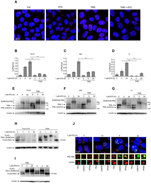 Figure 3. ATO-induced SUMOylation is counteracted by cell division. (A) IF showing HaCaT cells treated with the indicated combinations of 1.0μM ATO and 1.0mM TMD. Cells were pretreated for 12 hours with TMD before administration of ATO. Incubation was then continued with both drugs present for an additional 24 hours. DAPI (blue) and PML (red) is shown. Scale bar, 20 μm. (B-D) Quantification of CyPNs in HaCaT (B), NB4 (C), and T2 (D) cells after treatment with 1.0μM ATO and/or 1.0mM TMD as aforementioned in panel A. More than 200 cells were analyzed per sample. Data represent average of 2 independent experiments ± SD (***P < .001). (E-G) Western blot showing PML expression in HaCaT (E), NB4 (F), and T2 (G) cells treated with 1.0μM ATO and/or 1.0mM TMD as aforementioned in panel A. β-actin was used as loading control. (H) HaCaT cells stably expressing FLAG-PML1 were treated with 1.0μM ATO and harvested for analysis by Western blotting at indicated time points using urea or Triton X-100–based extraction buffers. β-actin was used as loading control. (I) HaCaT cells expressing FLAG-PML1 were treated with 1.0μM ATO and/or 1.0mM TMD as in panel A, and subsequently harvested for analysis by Western blotting at the indicated time points. β-actin was used as loading control. (J) IF analysis of HaCaT cells treated with 1.0μM ATO as indicated using antibodies against PML (red) and SUMO1 (green). Yellow rectangles highlight nuclear PML bodies (PML/SUMO1 colocalization), whereas green rectangles highlight CyPNs (absence of PML/SUMO1 colocalization). DAPI staining is shown in blue. Scale bar, 10 μm.