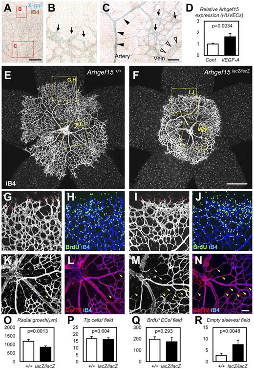 Figure 6. Arhgef15 stabilizes vessels in neonatal retinal vasculature. (A-C) X-gal staining combined with isolectin B4 (iB4) staining of Arhgef15+/lacZ retinas at P5. Arhgef15 is predominantly expressed in arterial ECs (closed arrowheads), whereas weaker expression was detected in venous (open arrowheads) and capillary ECs, including tip/stalk cells (arrows). (D) Quantitative PCR analysis of HUVECs cultured in the presence or absence of 50 ng/mL VEGF-A (12 hours) after 12 hours of serum starvation (n = 4). (E-N) Whole-mount IHC of P5 retinas with the indicated Abs. Arhgef15 KO mice showed delayed radial growth and sparse vasculature in the central retina (E-F). Although the number of tip cells (red points in G and I) and proliferation (H,J) were not affected, Arhgef15 KO mice showed markedly increased empty sleeves (Col IV(+) iB4(−); arrowheads in K-N). (O-R) Quantification of each parameter (n = 4). Scale bars: 500 μm (E-F), 200 μm (A), and 50 μm (B-C,G-N).