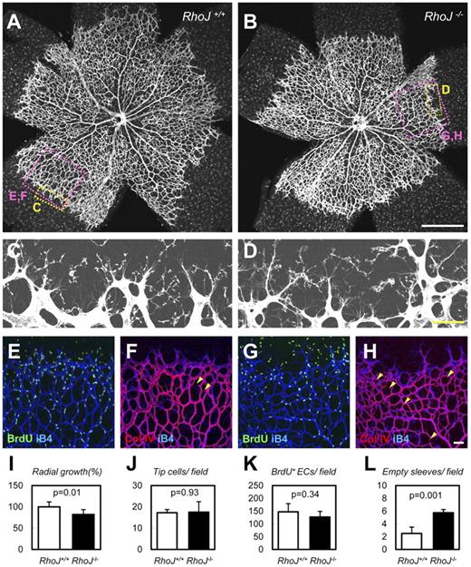 Figure 7. RhoJ stabilizes vessels in neonatal retinal vasculature. (A-H) Whole-mount IHC of P5 retinas with the indicated Abs. RhoJ KO mice showed delayed radial growth and increased empty sleeves (Col IV(+) iB4(−); arrowheads in F,H). (I-L) Quantification of each parameter (n = 4). Scale bars: 500 μm (A-B) and 50 μm (C-H).