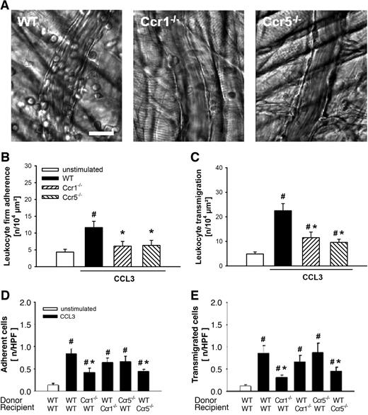 Figure 1. Role of CCR1 and CCR5 for CCL3-elicited leukocyte responses. (A) Representative RLOT in vivo microscopy images of postcapillary venules in WT, Ccr1-, and Ccr5-deficient mice after stimulation with CCL3 (scale bar: 20 μm). Leukocyte intravascular firm adherence and transmigration were quantified in postcapillary venules of the cremaster muscle as detailed in “Quantification of leukocyte kinetics and microhemodynamic parameters.” (B-C) Results for PBS-treated WT control mice as well as for WT, Ccr1-, and Ccr5-deficient mice after stimulation with CCL3 (mean ± SEM for n = 6 per group; #P < .05, vs unstimulated; *P < .05, vs WT). (D) Intravascular adherence and (E) transmigration of fluorescence-labeled bone marrow leukocytes were quantified in the cremaster muscle using in vivo fluorescence microscopy as detailed in “Quantification of florescent leukocyte responses.” Panels show results for WT mice receiving leukocytes from WT, Ccr1-, or Ccr5-deficient donors as well as for Ccr1- and Ccr5-deficient mice receiving leukocytes from WT donors after stimulation with CCL3 (mean ± SEM for n = 7 per group; #P < .05, vs unstimulated; *P < .05, vs WT→WT).