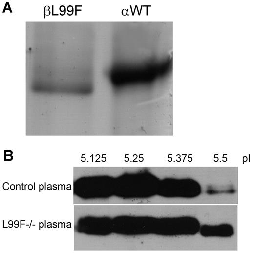 Figure 2. Antithrombin L99F (antithrombin Budapest-III); characterization of purified plasma glycoforms of homozygous patients. (A) SDS-PAGE and silver staining of β-L99F and α-wild type (αWT) glycoforms present in the heparin affinity chromatography fractions eluting at 1M NaCl from plasma of L99F and wild-type homozygous subjects. (B) Isoelectrofocusing of plasma samples. Isoelectrofocusing fractions from control plasma and one of the homozygous Budapest-III (L99F−/−) collected with an off-gel system were run under reduced SDS conditions and detected by Western blot. The fractions obtained between pI 5.5 and 5.63 mainly contained the β-glycoform of antithrombin.