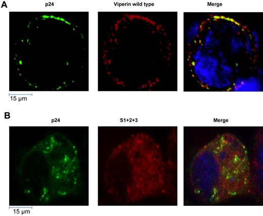 Figure 5. Intracellular distribution of HIV-1 and WT viperin or mutants in HEK293T cells. HEK293T cell were cotransfected with pWT/BaL proviral HIV-1 DNA and either WT viperin (A) or S1 + S2 + S3 domain mutants (B) for 72 hours. They were then fixed in 3% paraformaldehyde, permeabilized with 0.05% Triton-X, and labeled for viperin (red), p24 (green), and nucleus (blue). Images shown are representative of n = 10 cells and were acquired as described in Figure 1C.