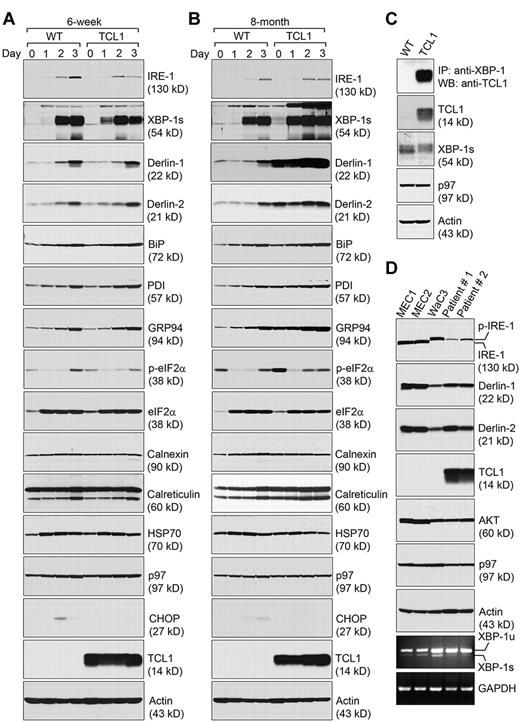 Figure 2. CLL cells express significantly increased levels of molecules involved in alleviating the ER stress. (A) CD5−/B220+ B cells purified from 6-week-old wild-type and Eμ-TCL1 mice were stimulated with LPS for a course of 3 days, and lysed for analysis by immunoblots for indicated proteins. Results shown in each immunoblot are representative of 3 independent experiments. For each experiment, CD5−/B220+ wild-type and Eμ-TCL1 B cells were purified and pooled from at least 2 mouse spleens. (B) CD5−/B220+ B cells purified from 8-month-old wild-type mice and CD5+/B220+ CLL cells from 8-month-old Eμ-TCL1 mice were stimulated by LPS for 3 days and lysed for analysis by immunoblots for indicated proteins. Results shown in each immunoblot are representative of 3 independent experiments. For each experiment, CD5−/B220+ wild-type B cells and CD5+/B220+ CLL cells were purified and pooled from at least 2 mouse spleens. (C) Association of TCL1 with XBP-1. CD5−/B220+ B cells purified from 8-month-old wild-type mice and CD5+/B220+ CLL cells from 8-month-old Eμ-TCL1 mice were stimulated by LPS for 3 days and lysed for analysis by immunoblots for TCL1, XBP-1, p97, and actin. The anti-XBP-1 Ab was used to perform immunoprecipitations from the same lysates, and the immunoprecipitates were analyzed for the presence of TCL1 (top panel). Results shown in each immunoblot are representative of 3 independent experiments. For each experiment, CD5−/B220+ wild-type B cells and CD5+/B220+ CLL cells were purified and pooled from at least 2 mouse spleens. (D) Human CLL cell lines (MEC1, MEC2, and WaC3) and freshly purified primary human CLL cells from 2 clinical patients (patient 1 and patient 2) were analyzed by immunoblots for the expression of indicated proteins. Unspliced and spliced forms of human XBP-1 mRNA (XBP-1u and XBP-1s, respectively), and human GAPDH mRNA were detected by reverse transcription followed by PCR using specific primers. Results are representative of 3 independent experiments.