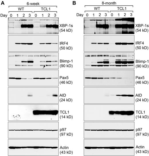 Figure 3. Eμ-TCL1 CLL cells express XBP-1, IRF4, Blimp-1, and AID at higher levels. (A) CD5−/B220+ B cells purified from 6-week-old wild-type and Eμ-TCL1 mice were stimulated with LPS for a course of 3 days, and lysed for analysis by immunoblots for indicated proteins. Data shown in each immunoblot are representative of 3 independent experiments. For each experiment, CD5−/B220+ wild-type and Eμ-TCL1 B cells were purified and pooled from at least 2 mouse spleens. (B) CD5−/B220+ B cells purified from 8-month-old wild-type mice and CD5+/B220+ CLL cells from 8-month-old Eμ-TCL1 mice were stimulated by LPS for 3 days and lysed for analysis by immunoblots for indicated proteins. Data shown in each immunoblot are representative of 3 independent experiments. For each experiment, CD5−/B220+ wild-type B cells and CD5+/B220+ CLL cells were purified and pooled from at least 2 mouse spleens.