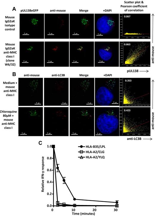 Figure 7. Colocalization of pUL138-eGFP and LC3 with internalized MHC class I molecules and acid stability of HLA-B35/LPL complexes. (A) T2.B35 pUL138-eGFP stable transfectants were cultured for 4 hours in complete medium containing mouse anti–human MHC class I (clone W6/32) or mouse IgG2aK isotype control, washed, and stained with AlexaFluor-546–conjugated goat anti–mouse IgG (shown in red). Colocalization of pUL138-eGFP with internalized MHC class I is shown in white. (B) Nontransfected T2.B35 cells were cultured in complete medium containing mouse anti–human MHC class I (clone W6/32), in the presence or absence of 80μM chloroquine, for 60 hours, washed, and stained with AlexaFluor-488–conjugated goat anti–mouse IgG (green) and anti-LC3B in AlexaFluor-546 (red). Colocalization of LC3 with internalized MHC class I is shown in white. (A-B) Blue represents nuclei staining with 4,6-diamidino-2-phenylindole (DAPI). Scale bars represent 5 μm. Original magnification ×64 (Olympus IX70 microscope, DeltaVision microscopy system). Image deconvolution and colocalization analysis performed with softWoRx. Right panels: scatter plots and degree of colocalization of anti-MHC class I or isotype control with pUL138 or LC3 by Pearson coefficient of correlation. Results are representative of 3 independent experiments. (C) T2.B35 pUL138-eGFP stable transfectants were treated with citric acid buffer (pH 3.0) for 0 to 30 minutes to dissociate peptide-MHC class I complexes, fixed in paraformaldehyde, and then used as antigen-presenting cells in an intracellular cytokine secretion assay. The acid stability of pUL138 HLA-B35/LPL was assessed in parallel with those of EBV LMP2 HLA-A2–restricted CLG and EBV LMP1 HLA-A2–restricted YLQ epitopes. Data shown were from 3 independent experiments, each performed in duplicate samples (mean ± SEM). The mean absolute percentages of T-cell response at time 0 were 32.0%, 4.5%, and 47.4% for HLA-B35/LPL, HLA-A2/CLG, and HLA-A2/YLQ, respectively.