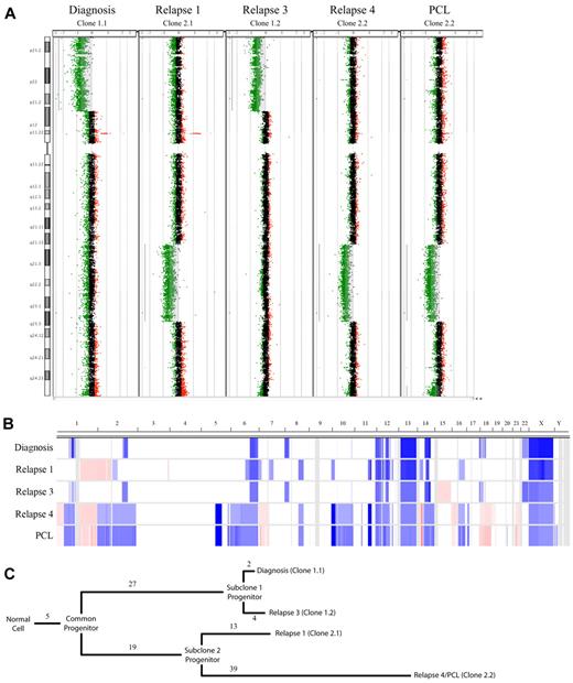Figure 3. Copy number analysis of a patient with high-risk MM. (A) A whole chromosome CGH dot plots for chromosome 8 are shown for each sample assayed. Statistically significant CNAs are indicated by light gray shading, which coincides with regions with extensive green dots (deletions) or red dots (amplifications). The 2 regions used to define subclone progenitors 1 and 2, which ebb and flow with time in this patient, are visible as large deletions on the 8p and 8q, respectively. (B) Heat map showing copy number changes in the 5 samples analyzed by Agilent 244k. Sample types are shown on the y-axis and ordered longitudinally. The chromosome location is on the x-axis. Blue shading indicates the presence of copy number loss; red, copy number gain; and white, no copy number abnormality. (C) Dendrogram showing the relation of the observed subclones. Branch length represents the number of CNAs detected by aCGH and assigned to each evolutionary step. There are 5 CNAs shared in all samples and a clear divergence of 2 subclone progenitors defined by 27 or 19 CNAs, respectively. Clones related to subclone progenitor 1 represent the major tumor population at diagnosis and relapse 3 and are differentiated by 2 and 4 CNAs, respectively. Clones related to subclone progenitor 2 represent the majority of the tumor population at relapse 1 and relapse 4/PCL, which are differentiated by 13 and 39 CNAs, respectively.