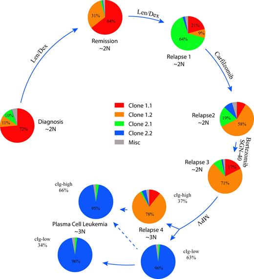 Figure 4. Clonal dynamics in a patient with high-risk MM. The summarized results of 8 different FISH assays are shown to indicate the relative abundance of each clone defined by aCGH at the 5 time points studied. Pie charts showing the relative proportions of each indicated clone are ordered clockwise starting on the left in longitudinal order. Arrow length is proportional to the time interval. The relative ploidy of the tumor population at each time point is also indicated. The cIg FISH of relapse 4 and the PCL identified clonal cells with low levels of cytoplasmic immunoglobulin (cIg-low) and larger cells with abundant cytoplasmic immunoglobulin (cIg-high) that were scored independently.