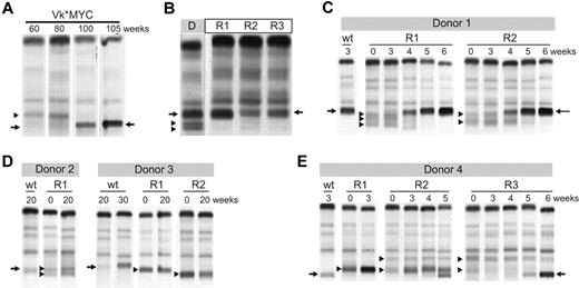 Figure 5. Clonal dynamics in a murine model of MM. (A) Serum protein electrophoresis performed at the indicated weeks on a biclonal Vk*MYC mouse shows the emergency at 80 weeks of a secondary clone that becomes dominant by 100 weeks. Arrows highlight the M-spike secreted by the dominant clone. Arrowhead points to the M-spike secreted by the competed out clone. (B) BM cells from a donor mouse (D) with a triclonal myeloma were transplanted into 3 wt congenic mice recipient mice (R). Serum protein electrophoresis shows engraftment of only 1 of the 3 clones in all 3 recipient mice. Arrows highlight the M-spike secreted by the dominant clone. Arrowheads point to the M-spikes secreted by the competed out clones. (C-E) BM cells from Vk*MYC myeloma-bearing mice (Donor) were transplanted into either wt congenic mice (wt) or recipient Vk*MYC mice with preexisting MM (R). Serum protein electrophoresis was performed at the indicated weeks after transplantation. Arrows highlight the M-spikes secreted by the donor mouse MM cells and arrowheads points to the preexisting M-spikes in the recipient mice.