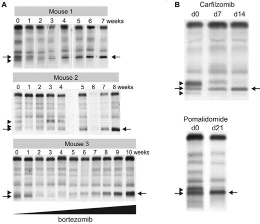 Figure 6. Therapy induced clonal dynamics in a murine model of MM. (A) Three independent Vk*MYC mice with biclonal or triclonal MM were treated biweekly with escalating doses of bortezomib (0.16-1 mg/kg). SPEP performed at the indicated weeks shows clonal modulation, with arrowheads pointing to the M-spikes secreted by the competed out clones, and arrows indicating the dominant bortezomib-resistant clones. (B) SPEP performed before and after carfilzomib or pomalidomide treatment of Vk*MYC mice with oligoclonal myeloma identifies responsive (arrowheads) and refractory (arrows) clones.