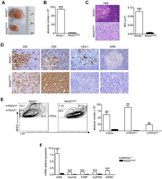 Figure 1. Thymic epithelial defect in RAG2R229Q mice. (A) Macroscopic aspect of representative 5-week-old RAG2+/+ and RAG2R229Q thymus. (B) Thymic cellularity in RAG2+/+ (n = 22) and RAG2R229Q (n = 33) mice; ***P < .0001. (C) Representative H&E staining of thymus from a 5-week-old RAG2+/+ and RAG2R229Q mouse (original magnification, ×20) and graphic representation of the M/C in the indicated mice (n = 8); ***P < .0001. (D) CK5, CK8, UEA-1, and AIRE immunohistochemistry of 5-week-old RAG2+/+ and RAG2R229Q thymus (original magnification, ×20). (E left) FACS analysis of thymic stromal compartment: CD45− fraction, obtained after enzymatic digestion was stained with MHCII and Ly51 Abs to identify the 3 different epithelial subsets. Numbers represent the percentage within the indicated regions. (Right) Absolute number of the different epithelial subpopulations obtained after enzymatic digestion of RAG2+/+ and RAG2R229Q thymi (n = 5); **P = .0025. (F) Real-time analysis of AIRE and indicated TRA transcripts on RNA extracted from total thymus of RAG2+/+ (n = 4) and RAG2R229Q mice (n = 4). Quantitative RT-PCR was run in triplicate (results are representative of 3 independent experiments); ***P = .0007.