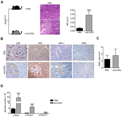 Figure 3. Improvement of thymic epithelium in Rag2R229Q mice 2 months after anti-CD3ε mAb administration. (A) Representative H&E staining of a thymus obtained from PBS and anti-CD3ε mAb-treated RAG2R229Q newborns (original magnification, ×20). (Right panel) Graphic representation of M/C ratio in the 2 groups (PBS n = 8, anti-CD3ε n = 9); ***P = .0003. (B) CK5, CK8, UEA-1, and AIRE immunohistochemistry of thymus from mice treated as indicated (original magnification, ×20). (C) Quantitative analysis of AIRE+ cells obtained as described in “Analysis of the ratio between medullary and cortical area and tissue-infiltration score” in PBS (n = 6) and anti-CD3ε mAb (n = 10) mice. (D) Absolute number of different epithelial cell subsets obtained after enzymatic digestion of thymi from PBS and anti-CD3ε mAb mice (n = 5); **P = .0079.