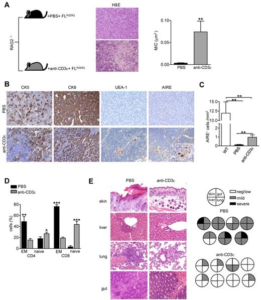 Figure 7. Anti-CD3ε mAb-mediated thymus development positively affects the selection of Rag2R229Q T-cell progenitors (indicated as FLR229Q). (A) Representative H&E staining of a thymus from PBS and anti-CD3ε mAb-treated chimeric mice (original magnification, ×20) and graphic representation of the M/C in the 2 groups (PBS n = 6, anti-CD3ε mAb n = 8); **P = .008. (B) Immunohistochemistry of thymi from PBS and anti-CD3ε mAb-treated mice (original magnification, ×20). In AIRE panel, the inset shows magnification of AIRE+ cells induced by the treatment (original magnification, ×40). (C) Quantitative analysis of thymic AIRE+ cells obtained as described in “Methods” in wild-type mice, chimeric mice treated with PBS (n = 6) and chimeric mice treated with anti-CD3ε mAb (n = 8); **P = .007 (D) Percentages of EM and naive cells within the donor-derived CD4+ and CD8+ populations in the 2 groups (n = 7); **P = .0028, ***P < .0001. (E left) H&E staining of skin (original magnification, ×10), lung, liver, and gut (original magnification, ×20) from PBS and anti-CD3ε mAb chimeric mice. (Right) Pie charts show global infiltration grade in each organ calculated from H&E staining as described in “Histology.” Each pie indicates tissue infiltration in individual mouse in the 2 groups.