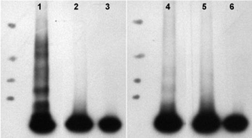 Figure 5. Autoradiogram of 125I-PF4 after incubation with KKO or RTO. Molecular mass markers are to the left of each panel correspond to 55, 71, 117, and 268 kDa. Lanes 1 and 4 show PF4 complexes with KKO (1) or RTO (4) that were subsequently cross-linked with bis-sulfosuccinimidyl suberate. Lanes 2 and 5 show PF4 cross-linked with bis-sulfosuccinimidyl suberate, and lanes 3 and 6 show PF4 alone (uncross-linked). Higher molecular mass PF4 complexes in the presence of the KKO comprise ∼ 60% of the total PF4 tetramers versus ∼ 2% with RTO. Data are representative of 3 such experiments.