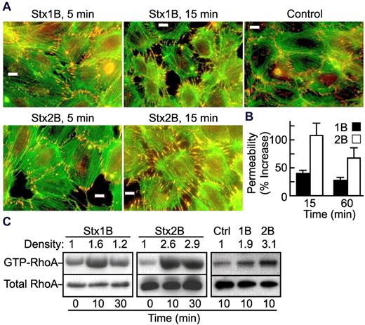 Figure 3. Stx1B and Stx2B activate RhoA and increase endothelial monolayer permeability. (A) Confluent HUVECs were treated with Stx1B or Stx2B for 5 or 15 minutes. Cells were then fixed, permeabilized, and stained for actin (green) and vinculin (red) as a marker for focal adhesions. Bars, 10 μm. (B) Confluent HUVECs on transwell filters were treated with 200 ng/mL Stx1B or Stx2B for 15 minutes or 1 hour. Monolayer permeability was measured by the penetration of FITC-dextrin to the bottom part of the transwell chambers. Results are shown as the mean ± SE for 5 independent experiments. Stx2B increased trans-endothelial permeability more than did Stx1B at both time points (P < .05). (C) HUVECs were treated with Stx1B or Stx2B for 10 or 30 minutes before lysis buffer was added. Cell lysates were probed for total RhoA or GTP-bound RhoA. The experiment was performed 3 times with similar results.