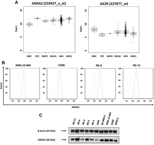 Figure 1. Expression of ANXA2 and validation of gene expression by flow cytometry and Western blotting. (A) Expression of ANXA2 and its receptor, AX2R, in memory B cells (MBCs), polyclonal plasmablastic cells (PPCs), normal plasma cells (BMPCs), myeloma cells (MMCs) and human myeloma cell lines (HMCLs). (B) To validate gene-expression data, the expression of ANXA2 was determined by flow cytometry. Light gray line indicates control without primary Ab; black line, measurement with the corresponding primary and secondary Abs. All cell lines show a consistent expression of ANXA2 by gene-expression profiling, real-time PCR, flow cytometry, and Western blotting (C). For Western blotting, β-actin was used as loading control.