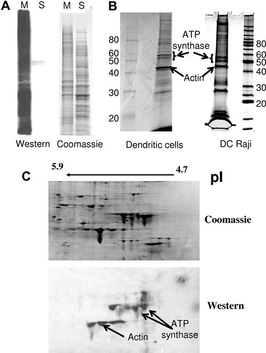 Figure 1. Composite figure describing the different fractions isolated and analyzed after photoaffinity labeling. (A) After photoaffinity labeling, DC-Raji cells were lysed and the membrane fraction (M) was isolated from the cytosolic fraction (S) by centrifugation as described in “Methods” for separation of proteins. Samples from both fractions were subjected to Western affinity staining with streptavidin-HRP for the identification of the biotin-containing fraction. (B) The membrane fraction of APC was solubilized in solubilization buffer, and the biotinylated proteins were isolated by affinity capture using streptavidin-agarose beads. Ten bands were subjected to digestion/tandem MS identification. An arrow indicates the identified band containing ATP synthase. The distribution of the peptides was as follows: DC-Raji cells (2 bands): band 1, 18 peptides of ATP synthase β-chain, 10 unique 15 peptides of ATP synthase α-chain, 9 unique. Altogether, 12 unique peptides of ATP synthase β-chain (19 total). Band 2, 9 peptides of ATP synthase β-chain, 9 unique, 6 peptides of ATP synthase α-chain, 5 unique. Altogether, 9 unique peptides of ATP synthase α-chain (14 total). DCs (2 bands): band 1, 38 peptides of ATP synthase β-chain, 15 unique 11 peptides of ATP synthase α-chain, 8 unique. Altogether, 14 unique peptides of ATP synthase β-chain (43 total). Band 2, 5 peptides of ATP synthase β-chain, 3 unique 24 peptides of ATP synthase α-chain, 14 unique. Altogether, 15 unique peptides of ATP synthase α-chain (35 total). Vimentin was also highly represented in those DC samples. (C) The membrane fraction was solubilized and subjected to 2D electrophoresis as described in “Methods” for separation of proteins. ATP synthase was identified in the spots indicated by an arrow. Peptides recovered (4 spots): 519 peptides of ATP synthase β-chain, 24 unique.